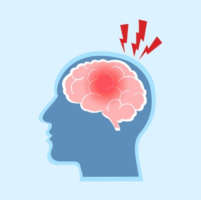 Picture for blog post Đau nửa đầu (migraine) – Căn bệnh không nên xem nhẹ