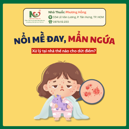 Picture for blog post NỔI MỀ ĐAY, MẨN NGỨA GIAO MÙA – XỬ LÝ TẠI NHÀ SAO CHO CHUẨN?
