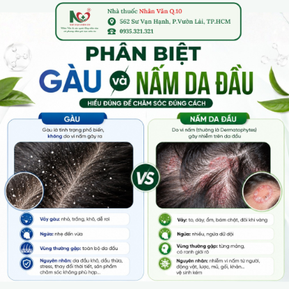Picture for blog post PHÂN BIỆT GÀU VÀ NẤM DA ĐẦU: ĐỪNG CHỦ QUAN VỚI TÌNH TRẠNG BONG TRÓC DA ĐẦU