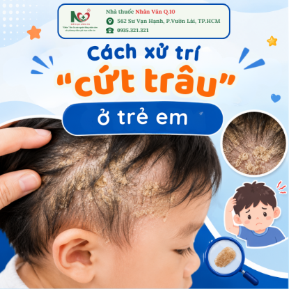 Picture for blog post CÁCH XỬ TRÍ "CỨT TRÂU" (VIÊM DA TIẾT BÃ) Ở TRẺ EM: BA MẸ CẦN BIẾT 