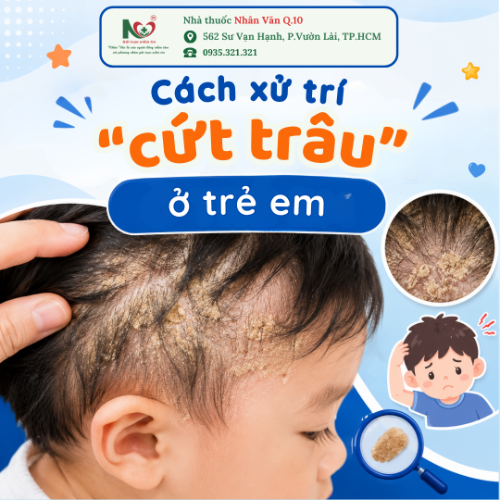 Picture for blog post CÁCH XỬ TRÍ "CỨT TRÂU" (VIÊM DA TIẾT BÃ) Ở TRẺ EM: BA MẸ CẦN BIẾT 