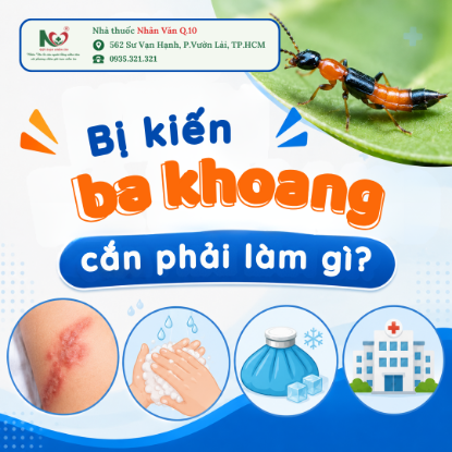 Picture for blog post BỊ KIẾN BA KHOANG CẮN PHẢI LÀM GÌ? CÁCH XỬ LÝ ĐÚNG ĐỂ TRÁNH TỔN THƯƠNG DA